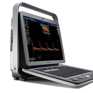 Portativ ultratovush apparati S9Exp.