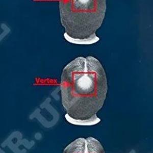 Миноксидил — лосьоны для волос и бороды