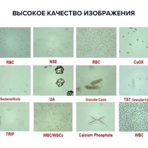 Siydikni avtomatik tahlil qilish stantsiyasi Laura XL