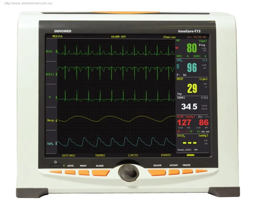 InnoCare-S bemor monitori