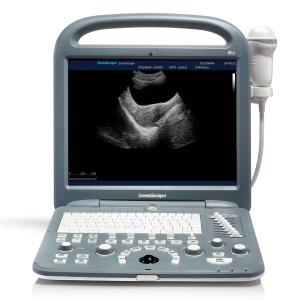 Portativ ultratovush apparati S2