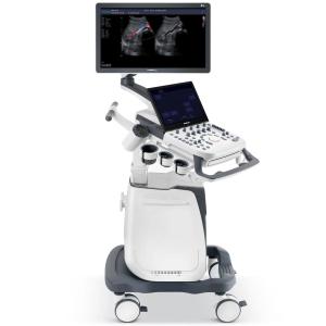 Ultratovush diagnostikasi tizimi P25