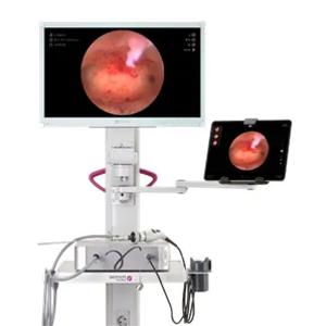 Endoskopik videokamera iCARE