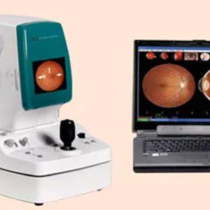 Немидриатическая цифровая фундус камера nonmyd a-D фирмы Kowa (Япония)