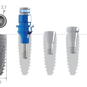 INNO-SUVGA BO'LGAN tor implantlar