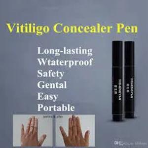 XISHENGYAN flamaster Vitiligo Oq Dog'lar Uchun moljallangan