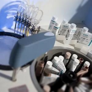 Avtomatik biokimyoviy analizator Erba XL-200