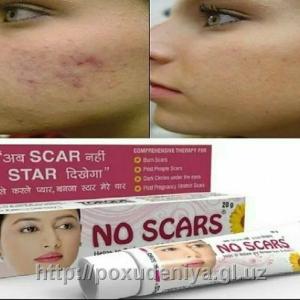 Skarsiz chandiq kremi