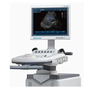 Ультразвуковая система (УЗИ) U2