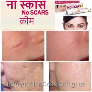 NO-SCAR chandiqga qarshi krem, 50 ml