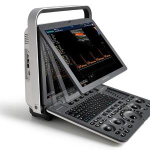 Portativ ultratovush apparati S8Exp.