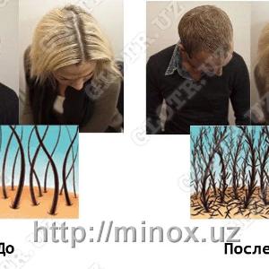 Sochlar orqali qabul qilish uchun MinoX Hair Magic