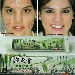 "Baliqchining xazinasi" malhami - toshbaqa kasalligi uchun