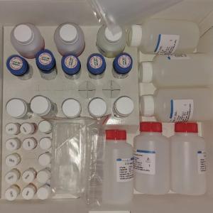 Ferment bilan bog'liq immunosorbent tahlili - «ВичИФА-HIV-Aг/Ат-СКРИН-О»