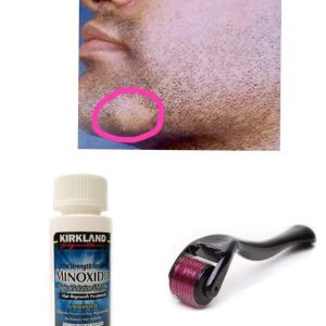 Dermaroller Mezoroller